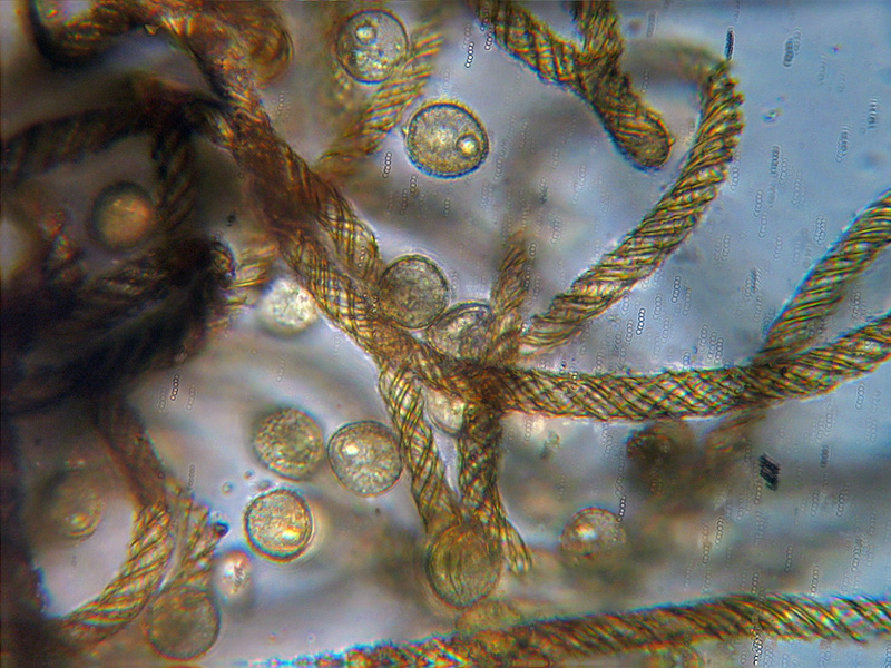 Ma non spariscono mai ?